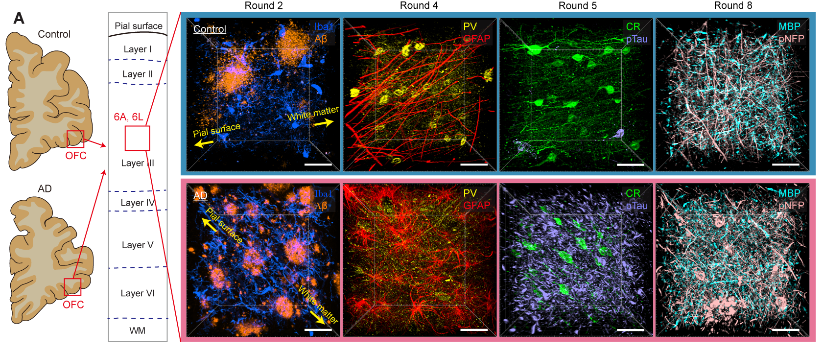 Technologies enable 3D imaging of whole human brain hemispheres at
